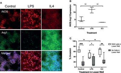 Inhibition of Anti-Inflammatory Macrophage Phenotype Reduces Tumour Growth in Mouse Models of Brain Metastasis